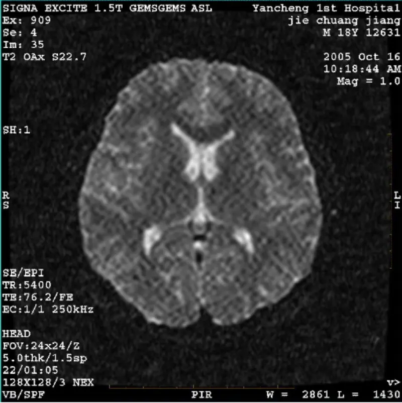 ARTIFACT WI/Fiesta Obrázek Bílý pixel